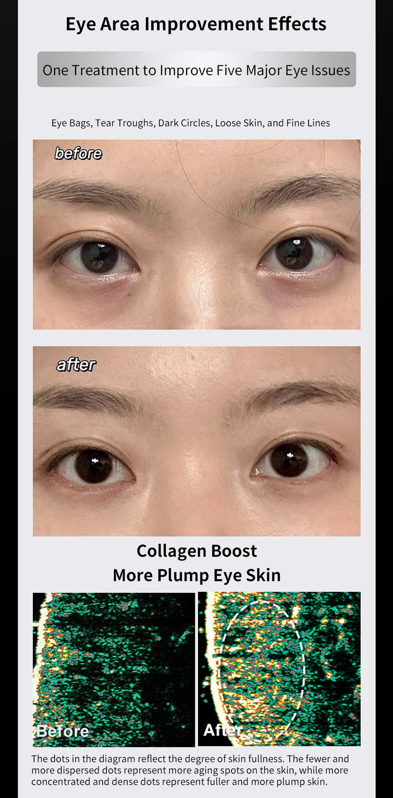 Equipamento de massagem ocular